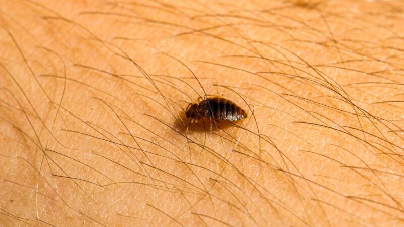 How to Tell Bed Bug Bites From Other Bites