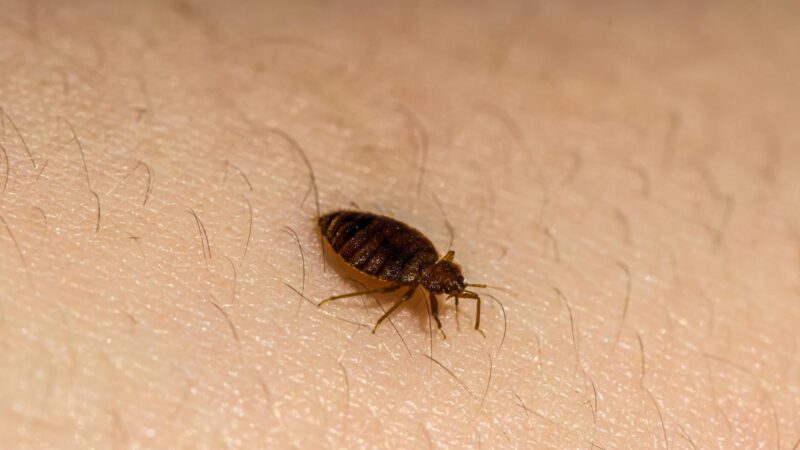 What to Do for Bed Bug Bites on Humans