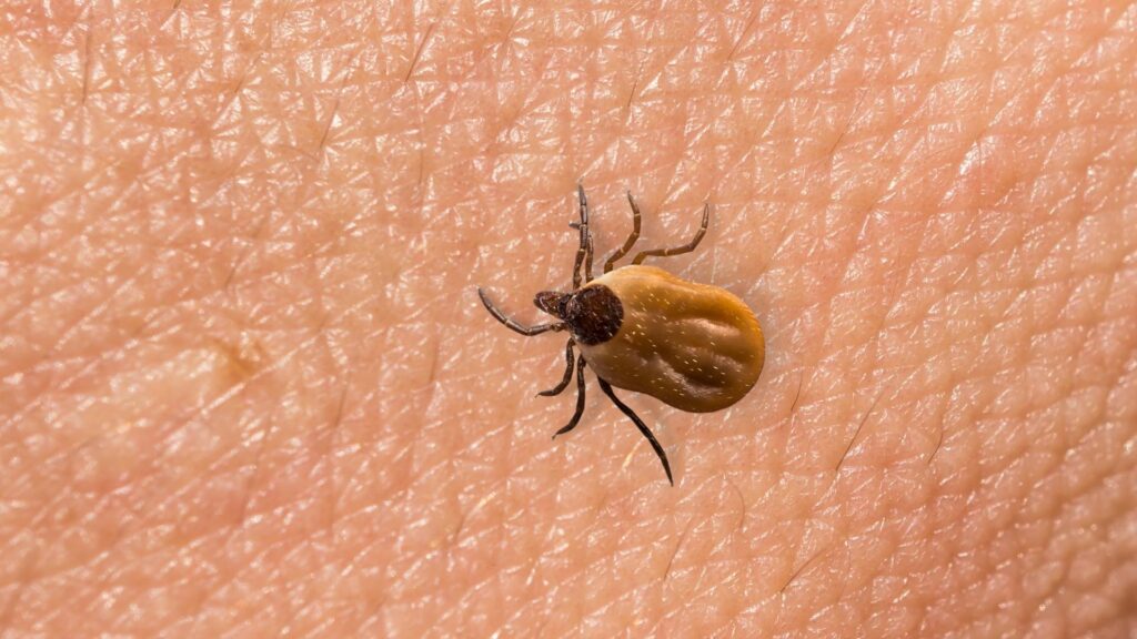 Does a Tick Bite Leave a Hard Lump